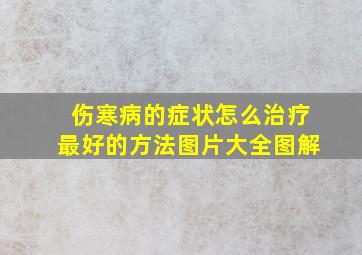 伤寒病的症状怎么治疗最好的方法图片大全图解