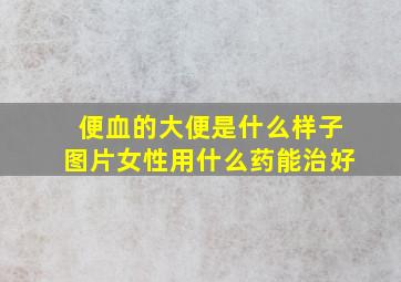 便血的大便是什么样子图片女性用什么药能治好