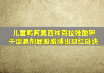 儿童喝阿莫西林克拉维酸钾干混悬剂屁股胳膊出现红斑块