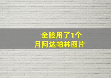 全脸用了1个月阿达帕林图片