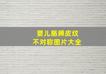 婴儿胳膊皮纹不对称图片大全