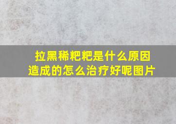 拉黑稀粑粑是什么原因造成的怎么治疗好呢图片