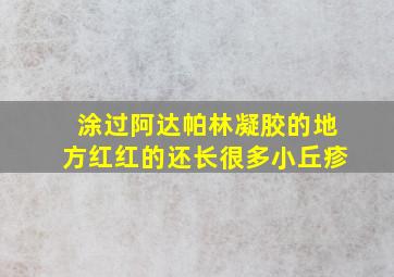 涂过阿达帕林凝胶的地方红红的还长很多小丘疹