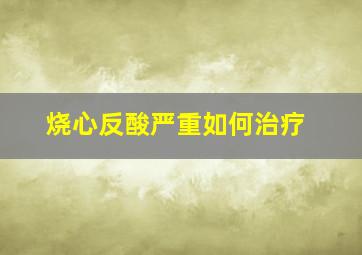 烧心反酸严重如何治疗