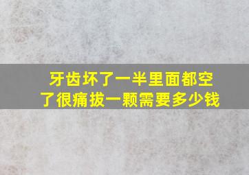 牙齿坏了一半里面都空了很痛拔一颗需要多少钱