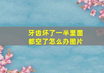 牙齿坏了一半里面都空了怎么办图片