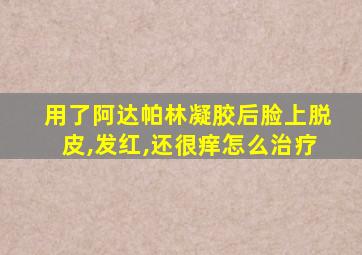 用了阿达帕林凝胶后脸上脱皮,发红,还很痒怎么治疗