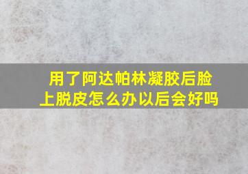 用了阿达帕林凝胶后脸上脱皮怎么办以后会好吗