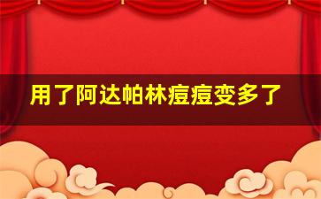 用了阿达帕林痘痘变多了