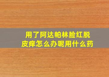 用了阿达帕林脸红脱皮痒怎么办呢用什么药