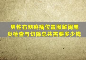 男性右侧疼痛位置图解阑尾炎检查与切除总共需要多少钱