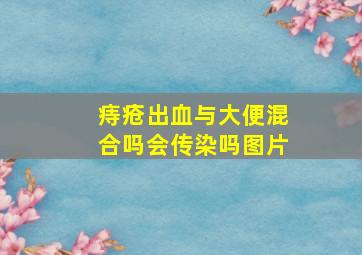 痔疮出血与大便混合吗会传染吗图片