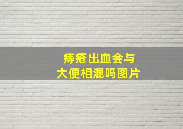 痔疮出血会与大便相混吗图片