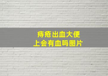 痔疮出血大便上会有血吗图片