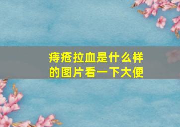 痔疮拉血是什么样的图片看一下大便