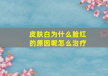 皮肤白为什么脸红的原因呢怎么治疗