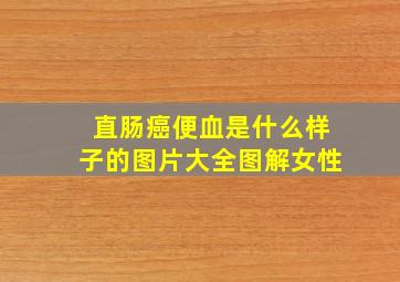 直肠癌便血是什么样子的图片大全图解女性