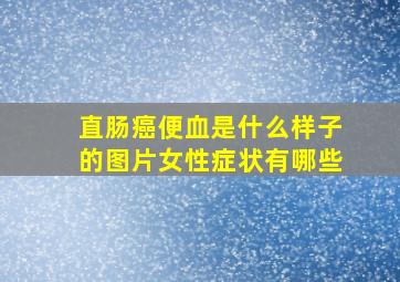 直肠癌便血是什么样子的图片女性症状有哪些