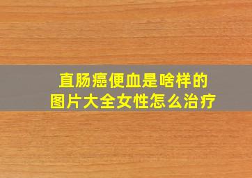 直肠癌便血是啥样的图片大全女性怎么治疗