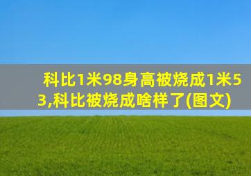 科比1米98身高被烧成1米53,科比被烧成啥样了(图文)