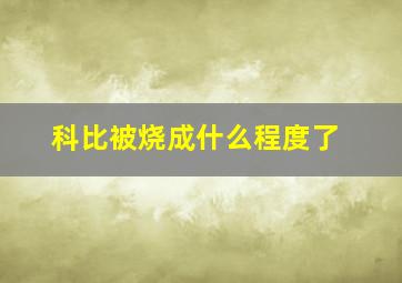 科比被烧成什么程度了