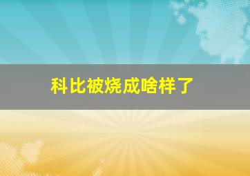 科比被烧成啥样了