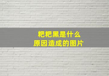 粑粑黑是什么原因造成的图片