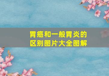 胃癌和一般胃炎的区别图片大全图解