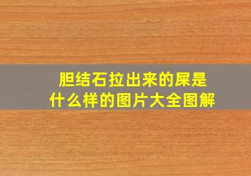 胆结石拉出来的屎是什么样的图片大全图解