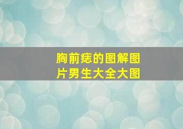 胸前痣的图解图片男生大全大图