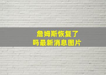 詹姆斯恢复了吗最新消息图片