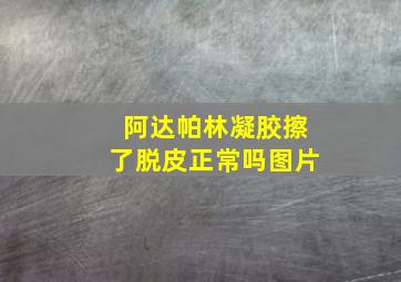 阿达帕林凝胶擦了脱皮正常吗图片