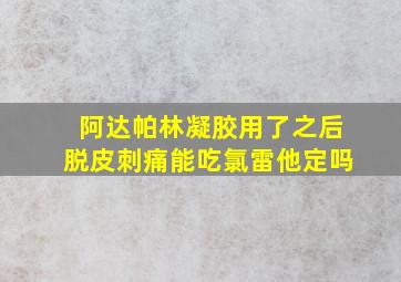 阿达帕林凝胶用了之后脱皮刺痛能吃氯雷他定吗