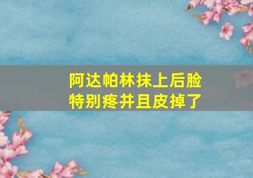 阿达帕林抹上后脸特别疼并且皮掉了