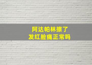 阿达帕林擦了发红脸痛正常吗