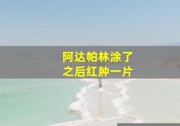 阿达帕林涂了之后红肿一片