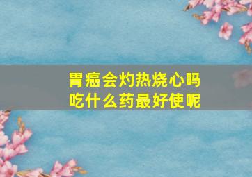 胃癌会灼热烧心吗吃什么药最好使呢